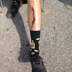 Gash