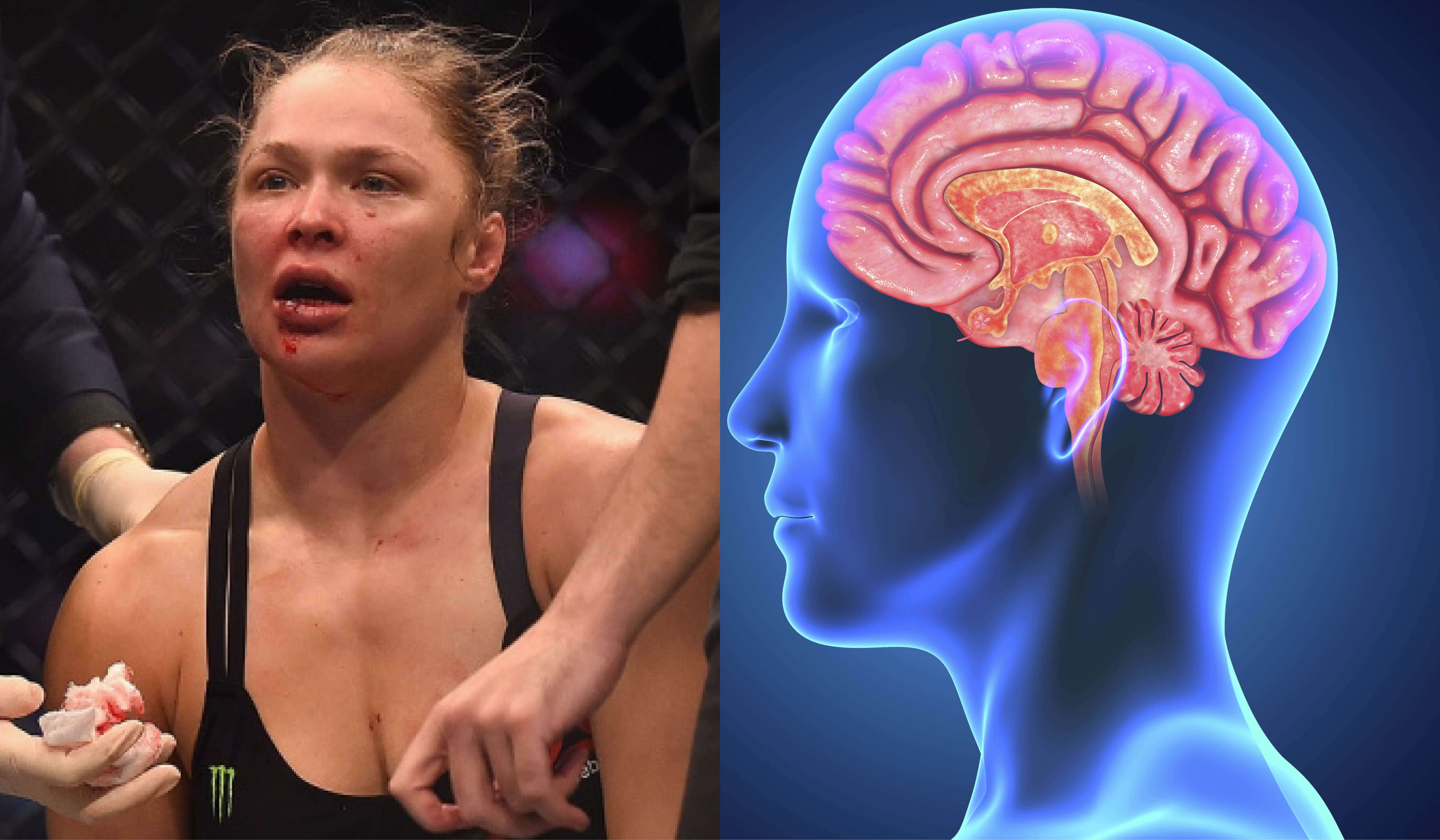 UFC CTE