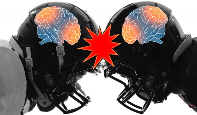 ConcussionGraphic concussion