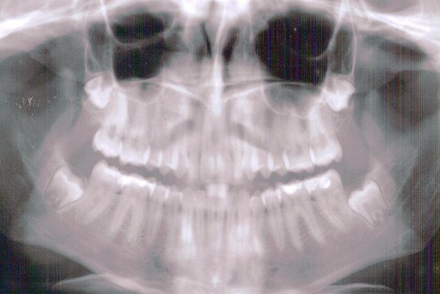 Dental xray dental contracts